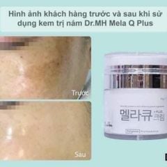 Kem trị Nám Tàn Nhang ban đêm Mela M 50gr