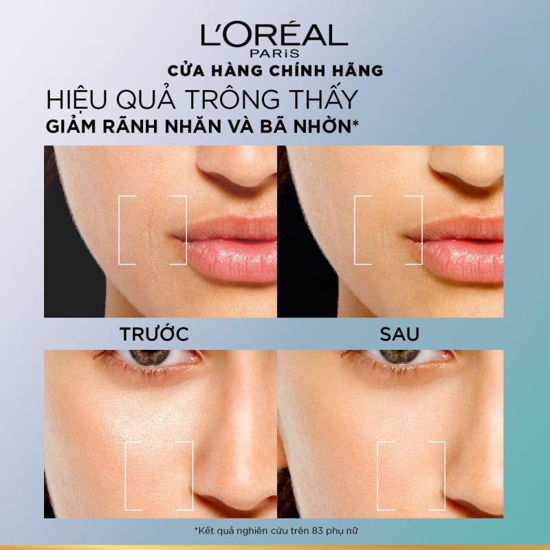 Kem Dưỡng Ban Ngày, Cấp Ẩm, Mịn Da L'oreal Paris Revitalift Hyaluronic Acid