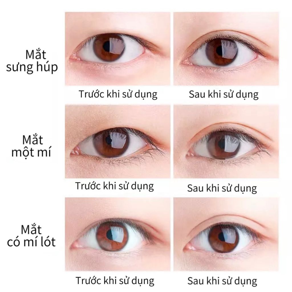 Miếng Dán Kích Mí XIXI 480m