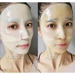 Mặt Nạ Dạng Thạch MediAnswer Mask 35g