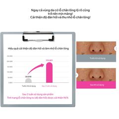 Tinh chất Serum Dưỡng Trắng Căng Bóng Da Maxclinic Glutathion ampoule shot 50ml