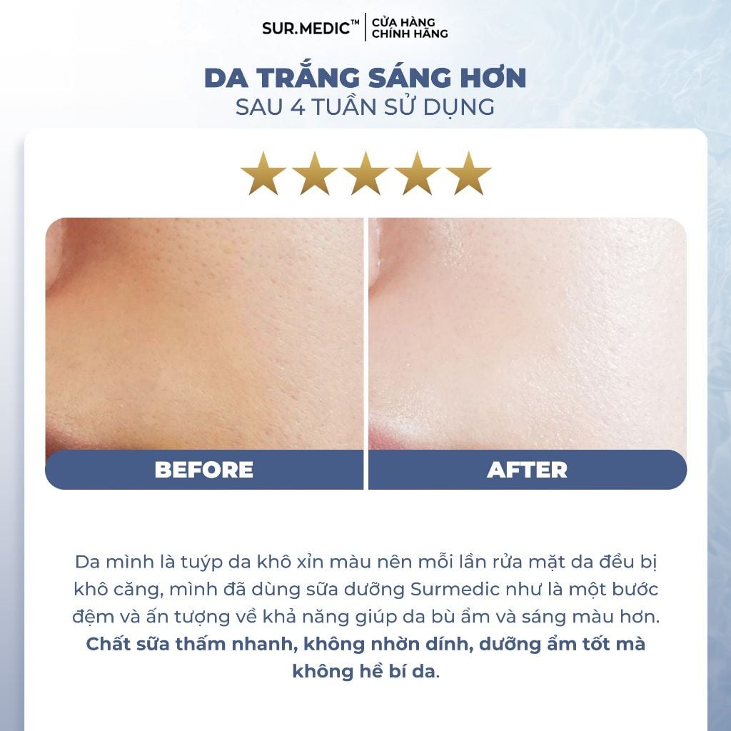 Sữa Dưỡng Trắng Da Sur.Medic Super Glutathione 100 Bright Emulsion