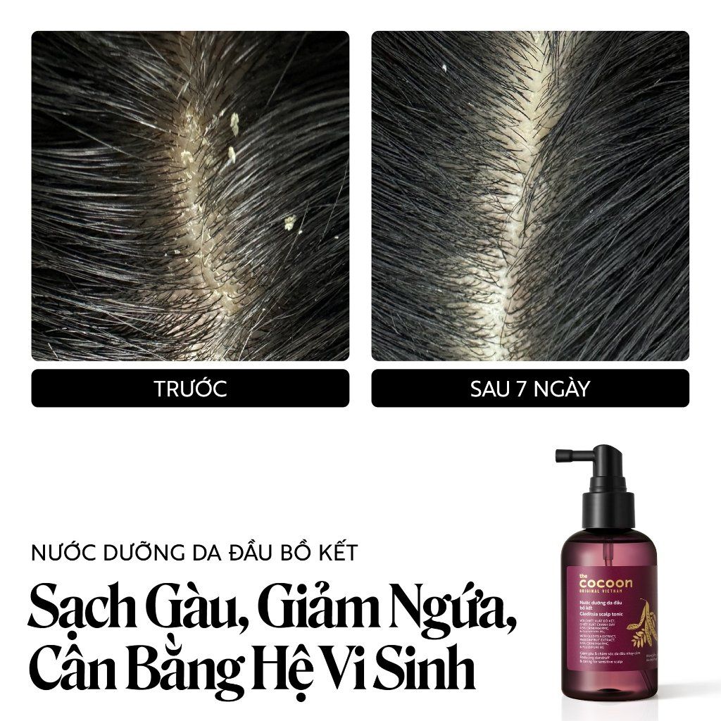 Nước Dưỡng Tóc Cocoon Bồ Kết Giảm Gàu Cho Da Đầu Nhạy Cảm