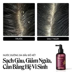 Nước Dưỡng Tóc Cocoon Bồ Kết Giảm Gàu Cho Da Đầu Nhạy Cảm