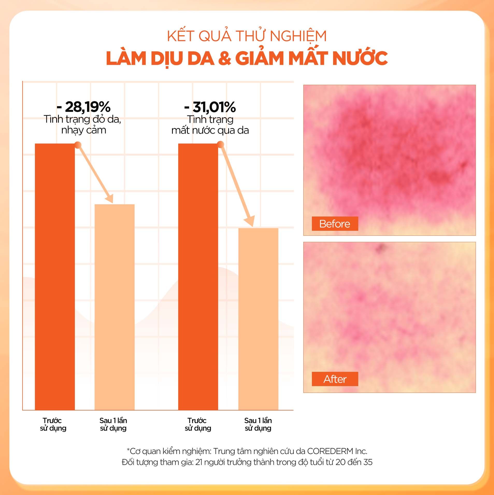  Nước hoa hồng Trà Xanh kiểm soát dầu nhờn và làm dịu Isntree Green Tea Fresh Toner 200ml 