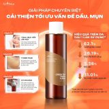  Nước hoa hồng Trà Xanh kiểm soát dầu nhờn và làm dịu Isntree Green Tea Fresh Toner 200ml 