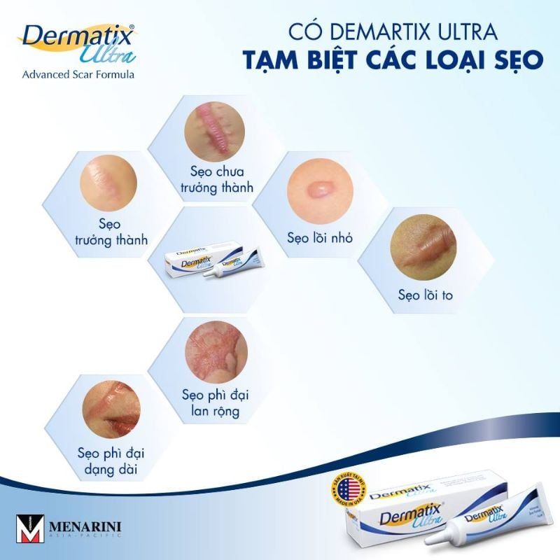Gel Dermatix Ultra - Giải Pháp Điều Trị Sẹo Lồi, Sẹo Phì Đại Hiệu Quả, Tuýp 7g