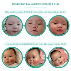 Xịt kháng khuẩn Dizigone, kháng khuẩn, khử mùi, giảm loét, chai 100ml