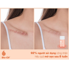 Dầu giảm rạn da và làm mờ sẹo Bio Oil Specialist Skincare Oil,  chai 125ml
