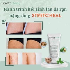 Kem trị rạn Stretcheal - Ngăn ngừa và làm mờ rạn da an toàn, hiệu quả cho bà bầu và sau sinh, tuýp 180ml