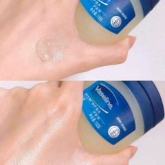 Sáp Vaseline 49g
