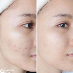 Neogen - Real Vita C Serum 32g