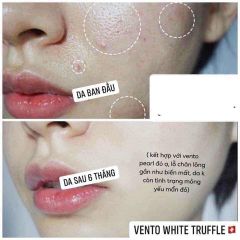 Kem Phục Hồi Tái Tạo Da Nấm Trắng Vento Vivere White Truffle Regeneration Cream Thụy Sĩ 50ml (Ko tđ)