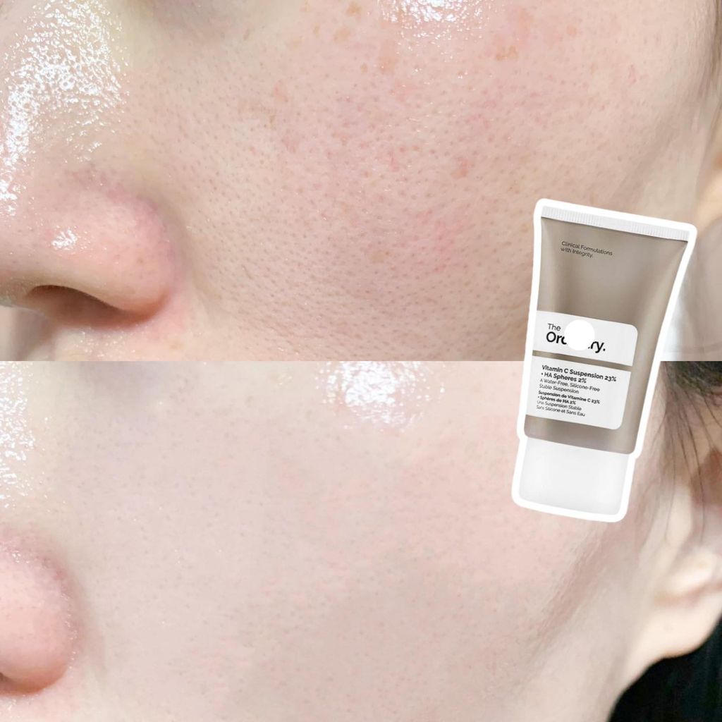 The Ordinary - Kem Dưỡng Sáng Da The Ordinary Vitamin C + HA 30ml