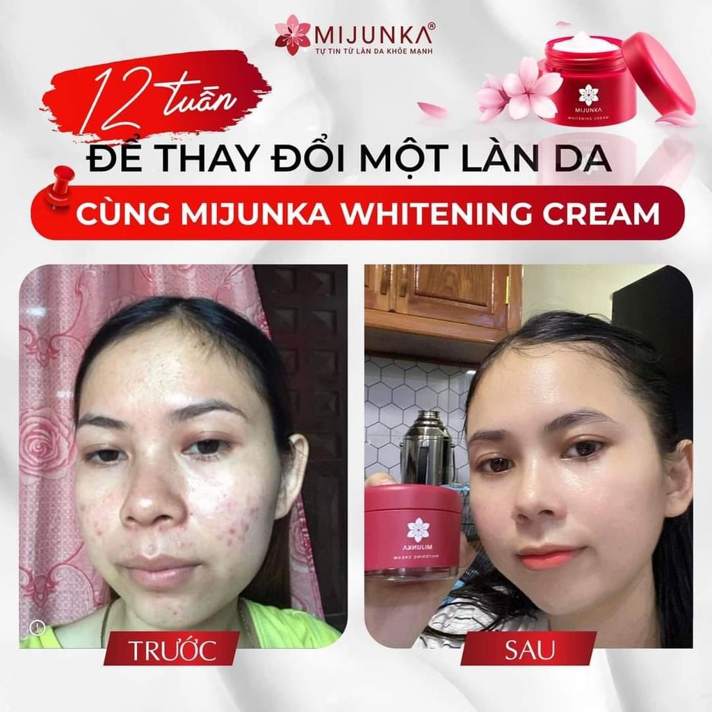 Mijunka - Whitening Cream 50g