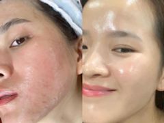 Mặt Nạ Dưỡng Và Phục Hồi Da SMAS Peptide Silk Mask Nhật