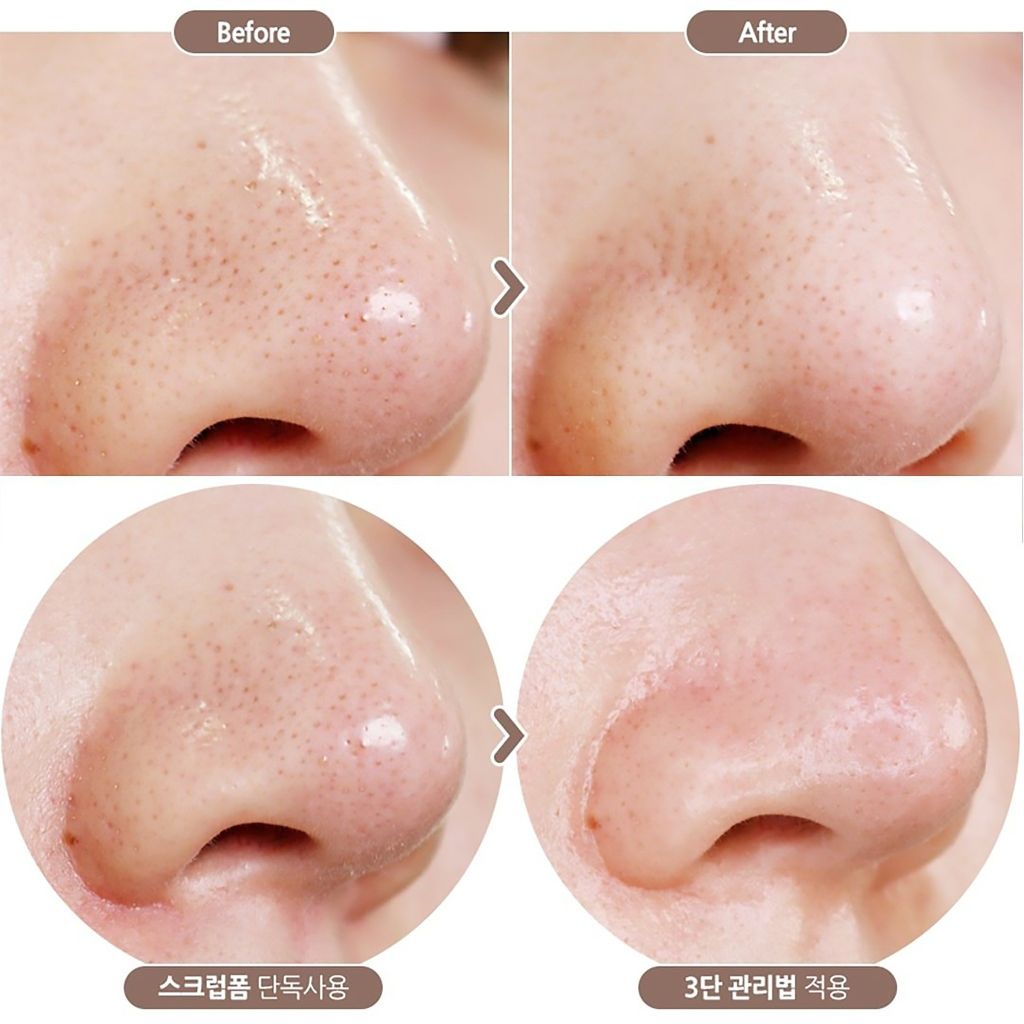 Innisfree - Sữa Rửa Mặt Innisfree Volcanic Pore BHA Cleansing Foam 150ml