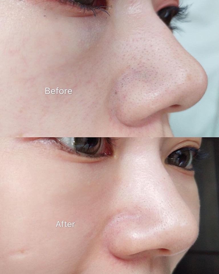 Kem dưỡng se khít lỗ chân lông Labo Labo VC Keana Gel Nhật 90g (Ko tđ)