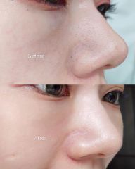 Kem dưỡng se khít lỗ chân lông Labo Labo VC Keana Gel Nhật 90g (Ko tđ)