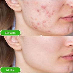 SVR - Sebiaclear Active Cream 40ml