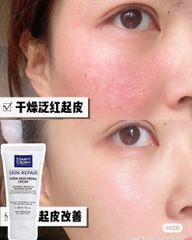 Kem Dưỡng Martiderm Skin Repair Cicra Vass Cream 30ml