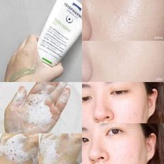 Sữa Rửa Mặt Isis Pharma TeenDerm Gel 150ml