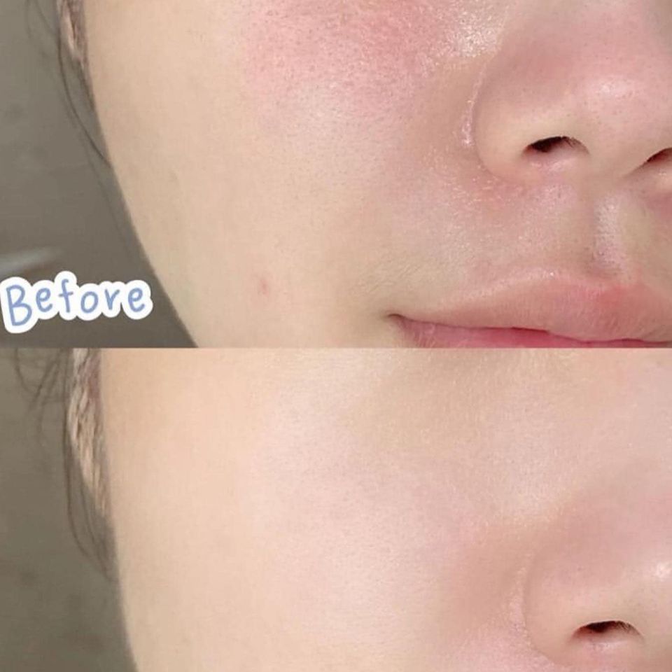 The Ordinary - Kem Dưỡng Sáng Da The Ordinary Vitamin C + HA 30ml