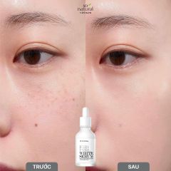 Tinh Chất Dưỡng Trắng Làm Đều Màu Da So Natural Red Peel White Serum 35ml