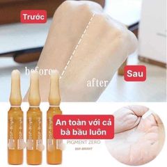 Martiderma - Ampoule Sáng Đều Màu Da, Giảm Đốm Sắc Tố Pigment Zero 2ml
