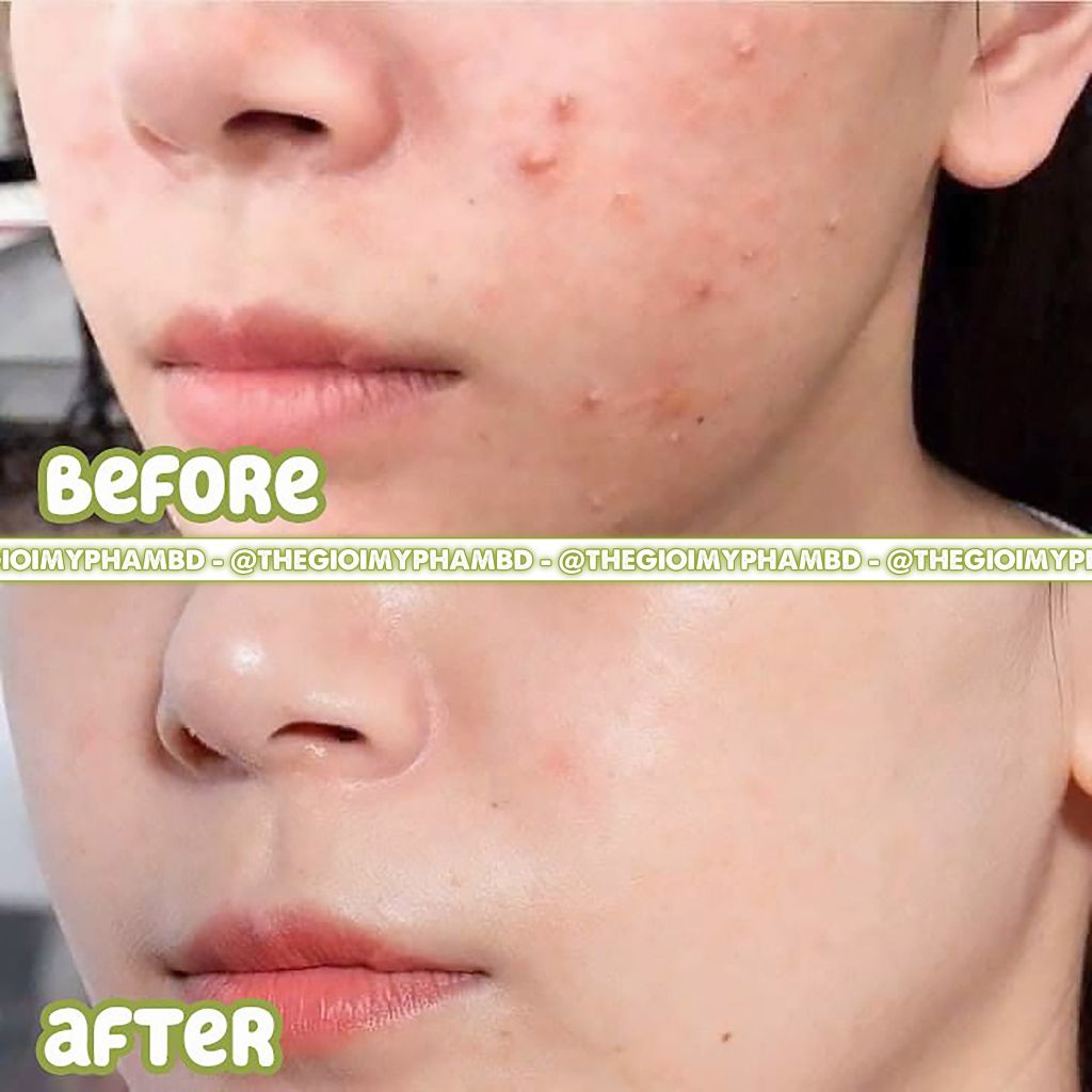 SVR - Sebiaclear Serum 30ml