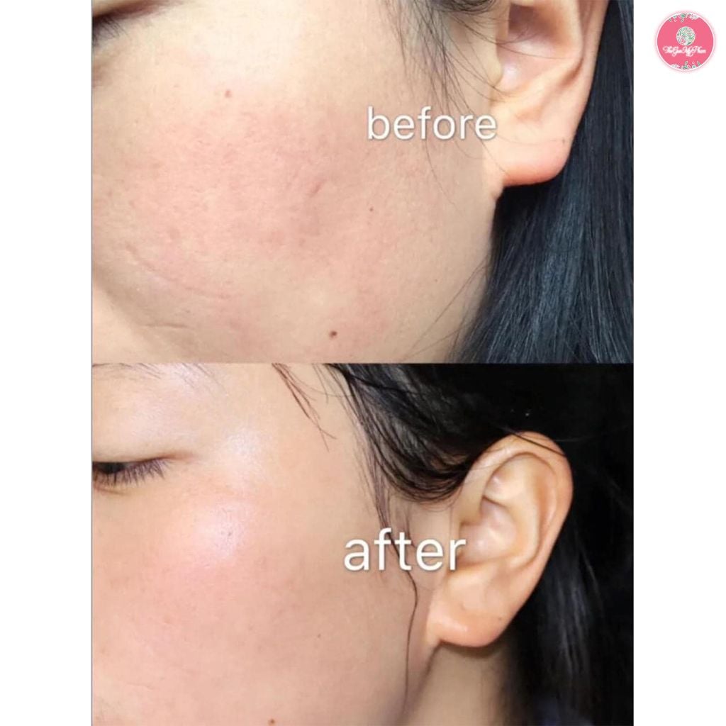 Kem Dưỡng Olay Total Effects 7 In One 50ml (Ngày/Không Mùi)