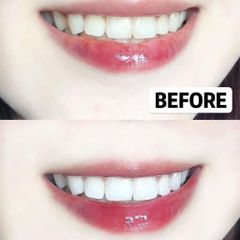 Bột Trắng Răng Eucryl