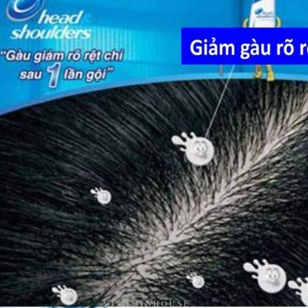 H&D - Dầu Gội Head & Shoulders Clinical Strength 400ml #Tím