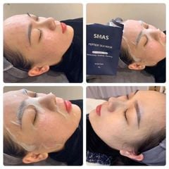 Mặt Nạ Dưỡng Và Phục Hồi Da SMAS Peptide Silk Mask Nhật