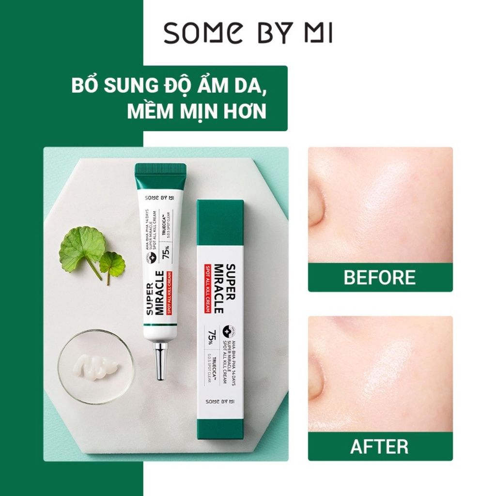 Some By Mi - Kem Dưỡng Đặc Trị Mụn 14 Days Super Miracle Spot All Kill