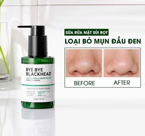 SRM Sủi Bọt Trị Mụn Đầu Đen Some By Mi Bye Bye Blackhead 30 Days Miracle Green Tea Tox Bubble Cleanser 120ml