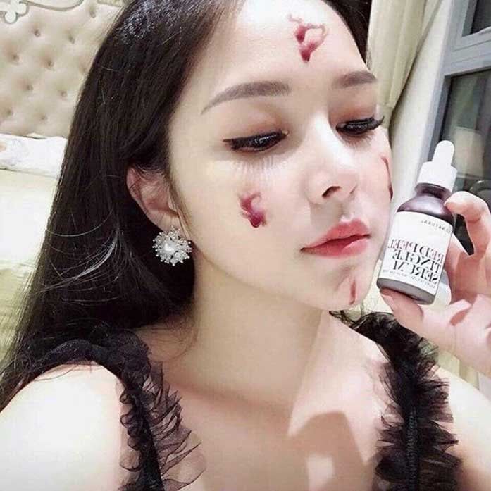 So Natural - Tinh Chất Red Peel Tingle Serum 35ml