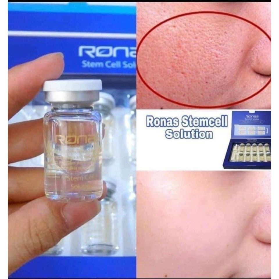 Tinh Chất Tế Bào Gốc Ronas Stem Cell Solution 10 ống x 5ml
