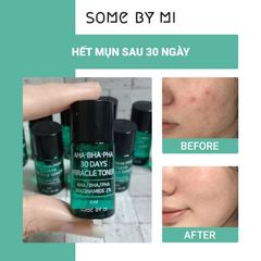 Some By Mi - Toner AHA BHA PHA 30 Days Miracle 6ml Mini ( tặng)