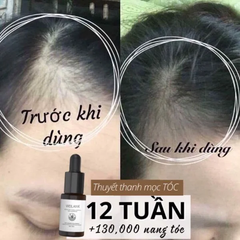 Weilaiya - Tinh Chất Kích Thích Mọc Tóc 5ml x 8 chai ( ko tđ)