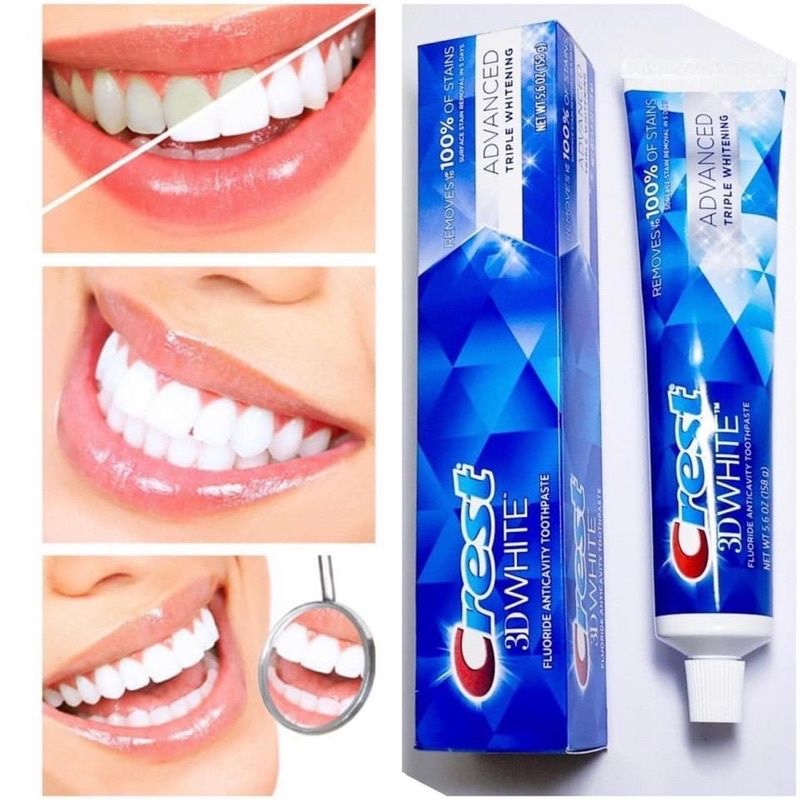 Kem Đánh Răng CREST 3D White Vivid Mint Ultra 147g