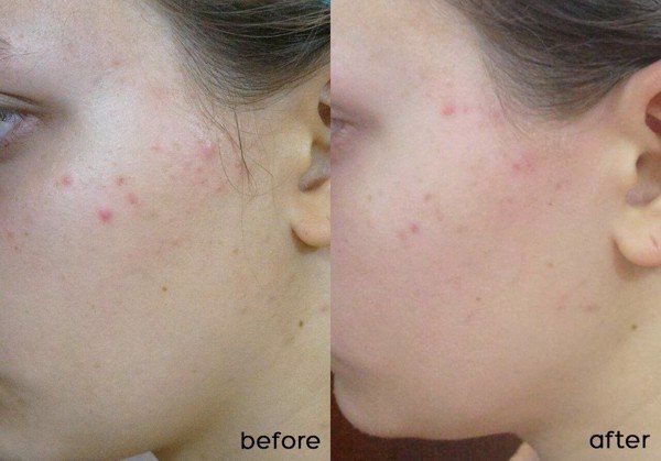 SVR - Sebiaclear Mat + Pores 40ml