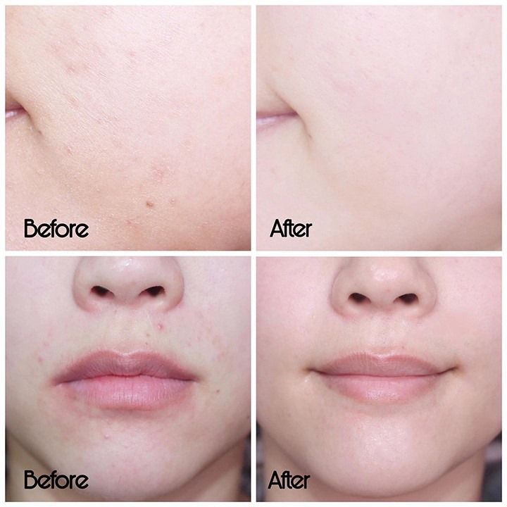 SVR - Sebiaclear Active Cream 40ml