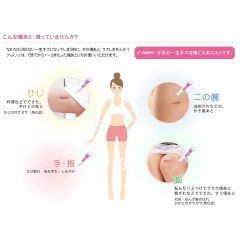 Trị sẹo mờ thâm Kobayashi EX Nhật