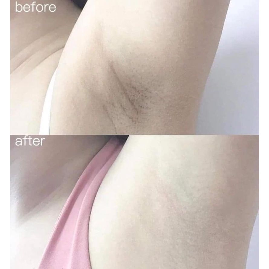 Trị Thâm Nách Alpha Arbutin 3 Plus Organic Underarm Night Cream 50g