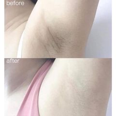 Trị Thâm Nách Alpha Arbutin 3 Plus Organic Underarm Night Cream 50g