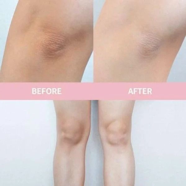 Trị Thâm Nách Alpha Arbutin 3 Plus Organic Underarm Night Cream 50g