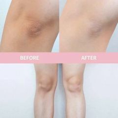 Trị Thâm Nách Alpha Arbutin 3 Plus Organic Underarm Night Cream 50g