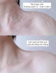 Muối bò Abonne Yogurt