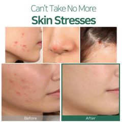 Some By Mi - Tea Tree Clear Spot Oil 10ml